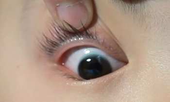 如何正確配隱形眼鏡伴侶盒